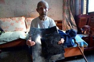Duan Zhicai muestra su radiografia